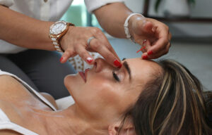Cosmetic facial acupuncture at Nayeli Integrative Health Clinic – fine needles targeting skin tone and energetic flow.