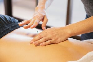 Acupuncture treatment at Nayeli Integrative Health Clinic – practitioner inserting a needle in a client’s back to restore balance.